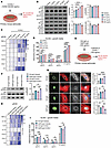 CHI3L1 activates astrocytic NF-κB and potentiates AQP4-IgG–evoked proinflam