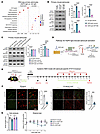Astrocytic STAT3 drives CHI3L1 induction and NF-κB activation to mediate NM