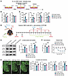 STAT3 inhibition with WP1066 ameliorates demyelination and motor deficits i