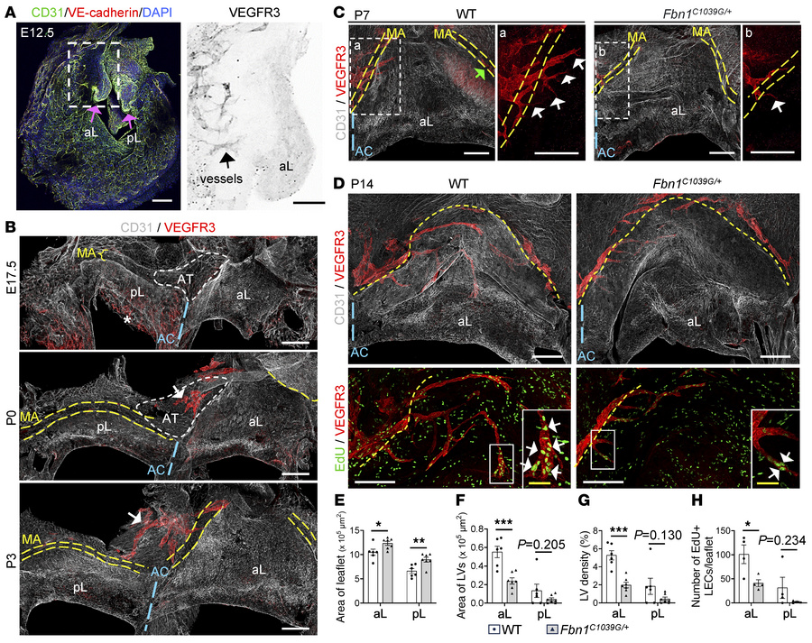 Development of LVs is inhibited in Fbn1 mutant MVs.
Whole-mount immunost...