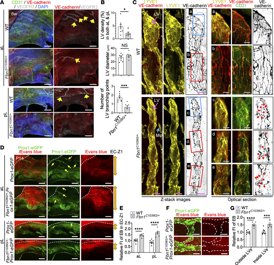 Lymphatic defects in Fbn1 mutant MVs.
(A) Representative confocal images...