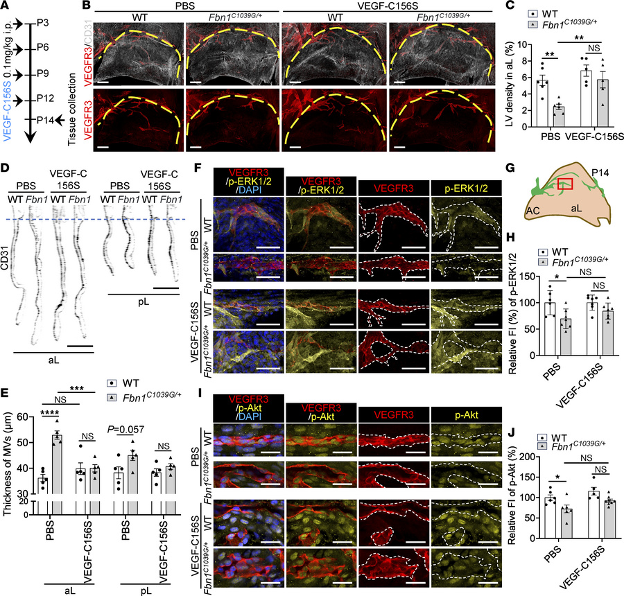 VEGF-C156S promotes lymphatic growth in the MVs and ameliorates MV thick...