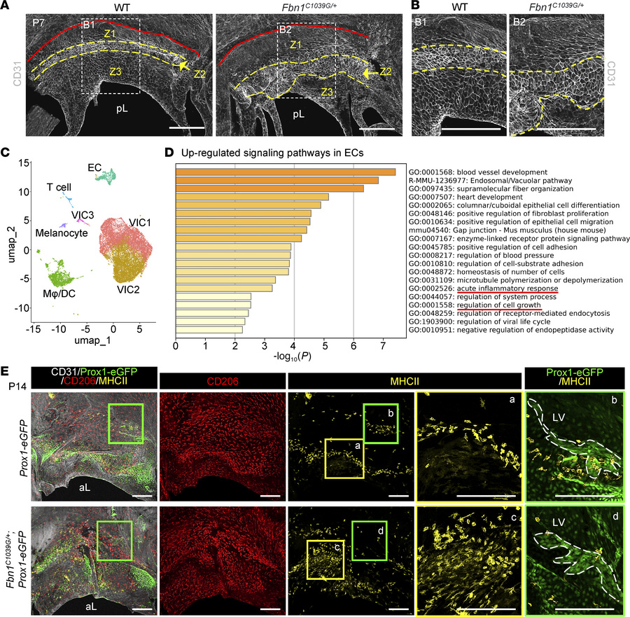 Inflammation is increased in MVs of Fbn1 mutant mice.
(A and B) Represen...