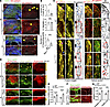 Lymphatic defects in Fbn1 mutant MVs.