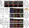 VEGF-C156S promotes lymphatic growth in the MVs and ameliorates MV thickeni