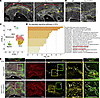 Inflammation is increased in MVs of Fbn1 mutant mice.