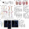 FTY720 rescues MDMV phenotypes in Fbn1 mutant mice.