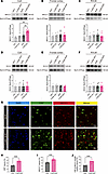 CUMS results in the up-regulation of NKCC1 without affecting KCC2 in the Ce