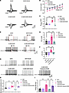NKCC1 activation contributes to hyperactivity of CeA CRF-expressing neurons
