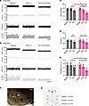 NKCC1 inhibition reduces sympathetic vasomotor tone and enhances sympathoin