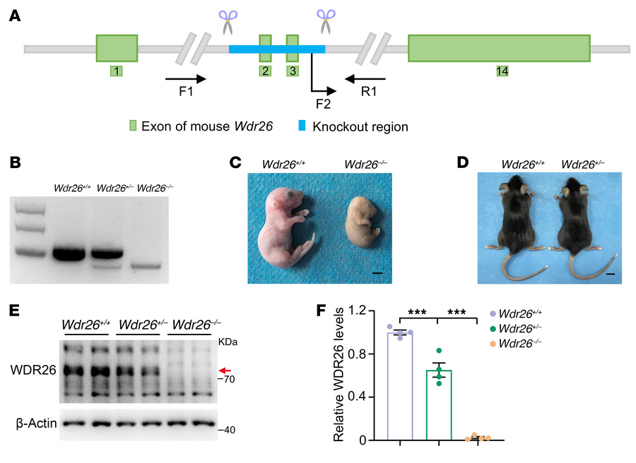 
Wdr26+/– mice are established and verified.
(A) The illustration showed...