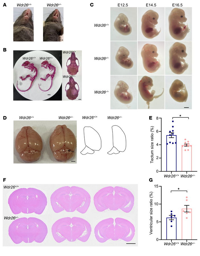 
Wdr26+/– mice show developmental abnormalities, with a small proportion...
