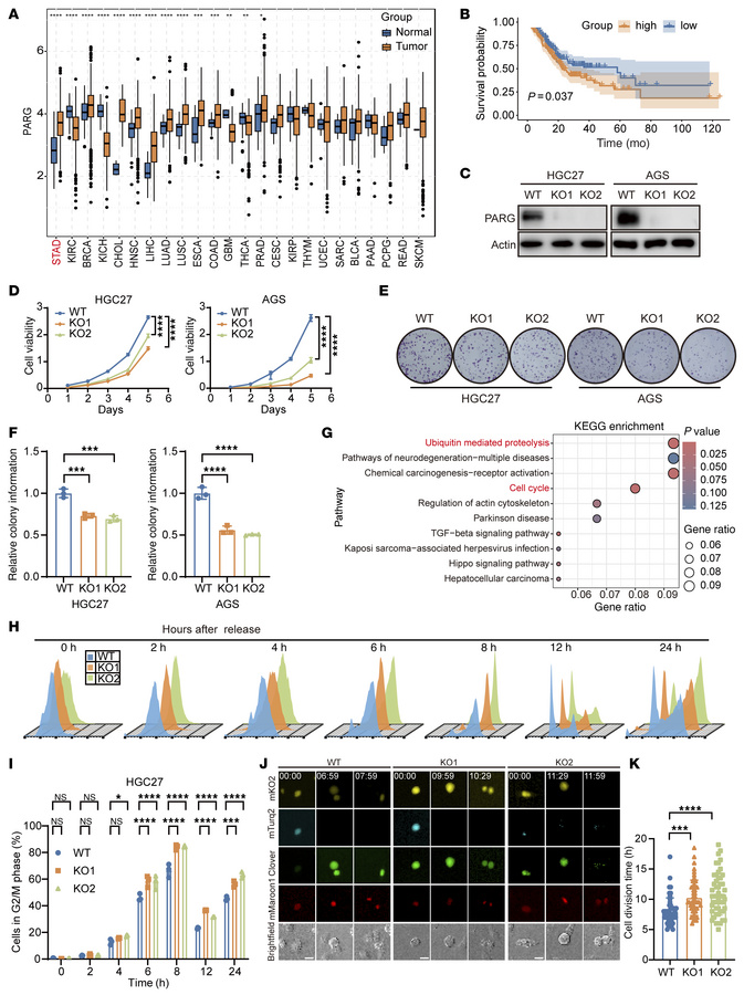 PARG promotes cell proliferation and orchestrates cell cycle progression...