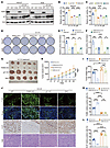 p21 governs G C-K sensitivity in PARG-deficient cancer.