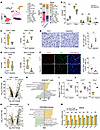 OLIG2 deletion enhances T cell activation and inhibits protumor TAMs in GBM