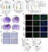 OLIG2 deficiency strengthens the effects of anti–PD-L1 therapy in GBMs.