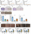 miR-340 and miR-382 inhibit cell proliferation, invasion, and neurosphere f