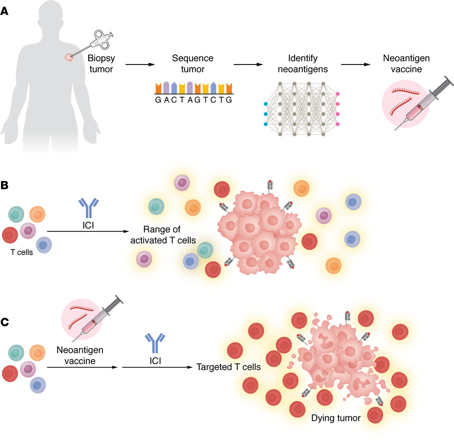The process and effects of neoantigen vaccines to bring specificity to t...