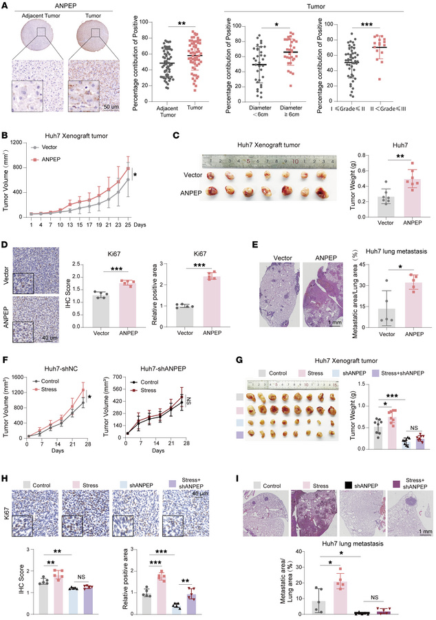 ANPEP mediates chronic stress–induced liver cancer progression.
(A) Repr...