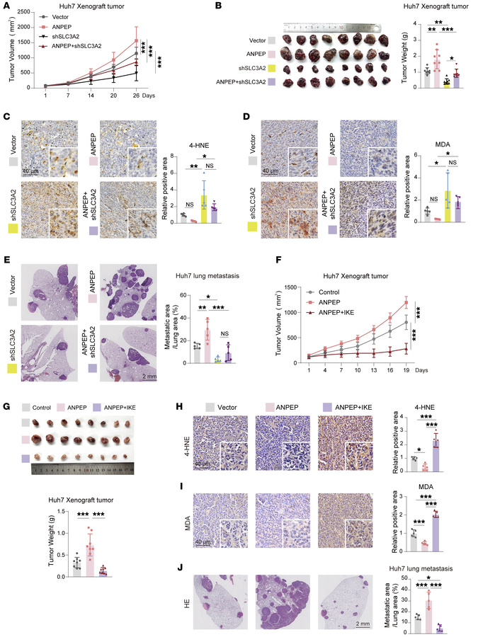 ANPEP promotes liver cancer progression via SLC3A2-mediated inhibition o...