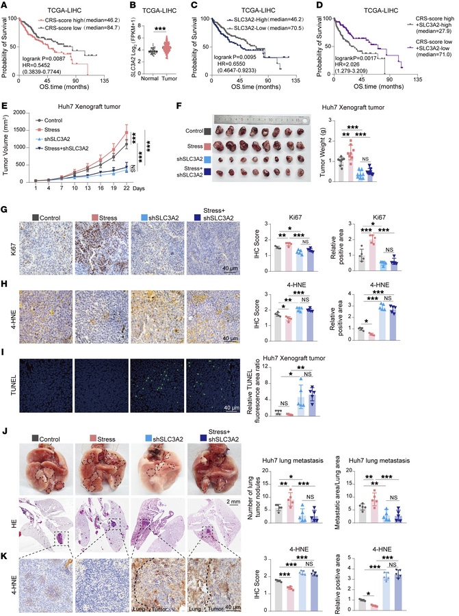 increasing glutathione Glutathione overproduction mediates lymphoma initiating cells survival and  has a sex-dependent effect on lymphomagenesis