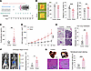 Chronic stress promotes the progression of liver cancer.
