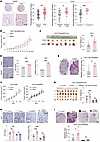 ANPEP mediates chronic stress–induced liver cancer progression.
