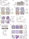 ANPEP promotes liver cancer progression via SLC3A2-mediated inhibition of l