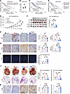 SLC3A2 as a therapeutic target to counteract the tumor-promoting effects of