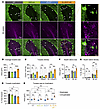 PC torpedoes and myelin debris in the granular layer are increased in OL-SC