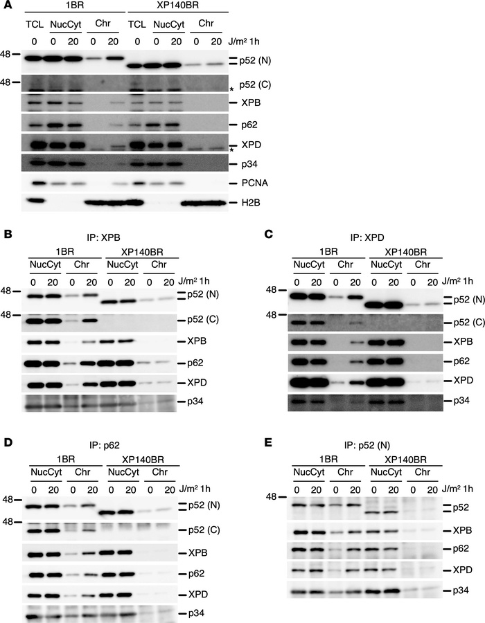 TFIIH recruitment to the chromatin fraction after DNA damage is compromi...