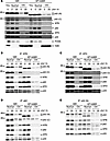 TFIIH recruitment to the chromatin fraction after DNA damage is compromised