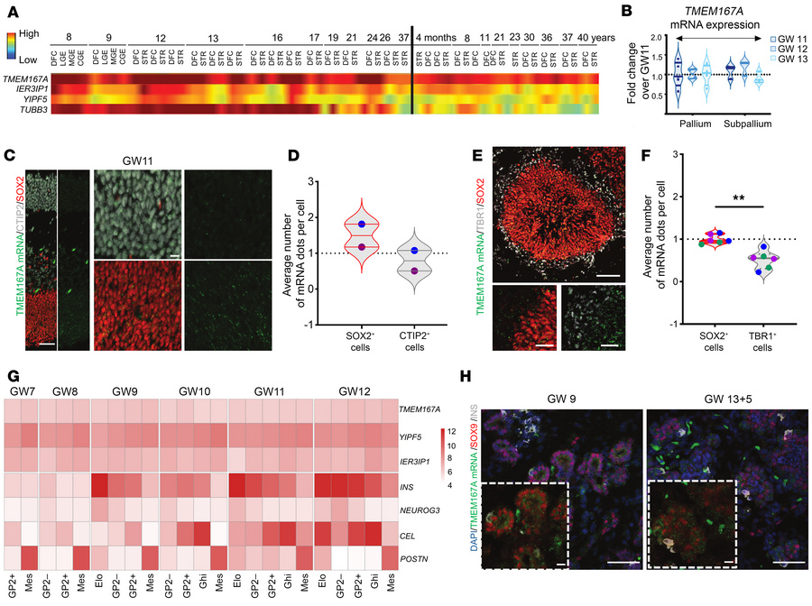 Expression of TMEM167A in human brain and pancreas.
(A) TMEM167A, IER3IP...