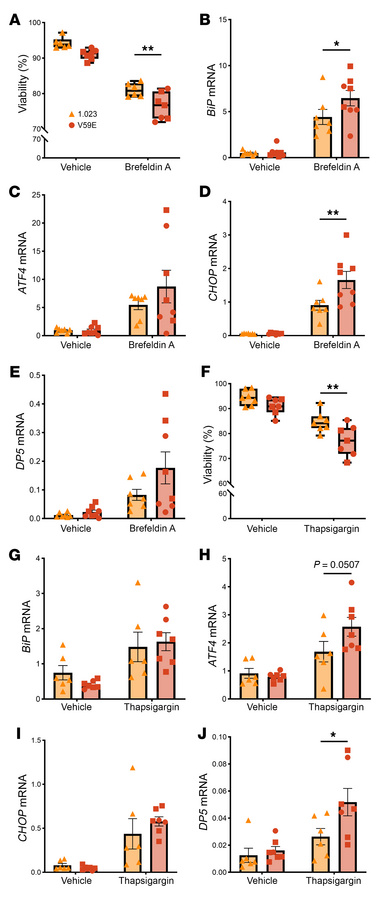 TMEM167A V59E variant–carrying β cells are sensitive to ER stress–induce...