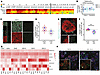 Expression of TMEM167A in human brain and pancreas.