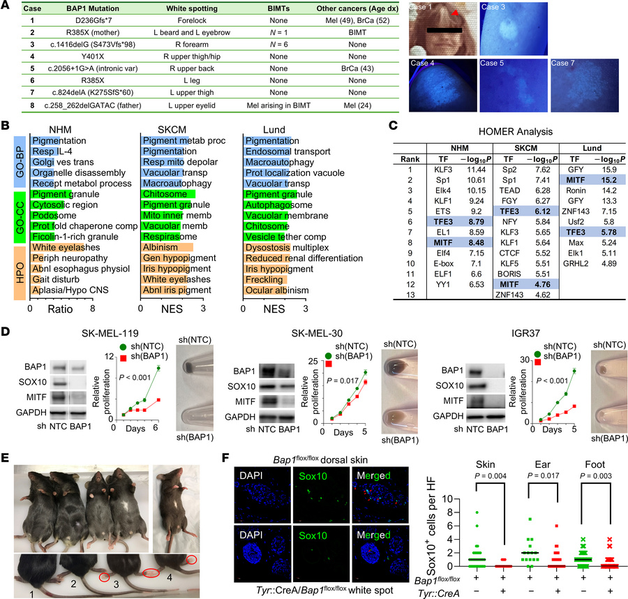 
BAP1 inactivation and pigmentation.
(A) Patient details and images of w...