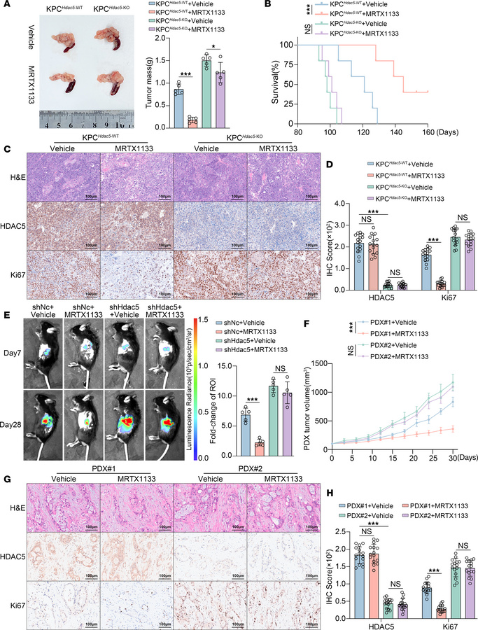 Loss of HDAC5 induces intrinsic resistance to KRAS inhibitor in vivo.
(A...