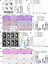 Loss of HDAC5 induces intrinsic resistance to KRAS inhibitor in vivo.