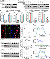 Loss of HDAC5 promotes the stabilization of c-Myc protein.