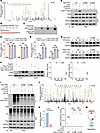 HDAC5 loss disrupts the acetylation-ubiquitination homeostasis at lysine 14