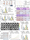 Pharmacological or genetic inhibition of c-Myc overcomes the resistance to
