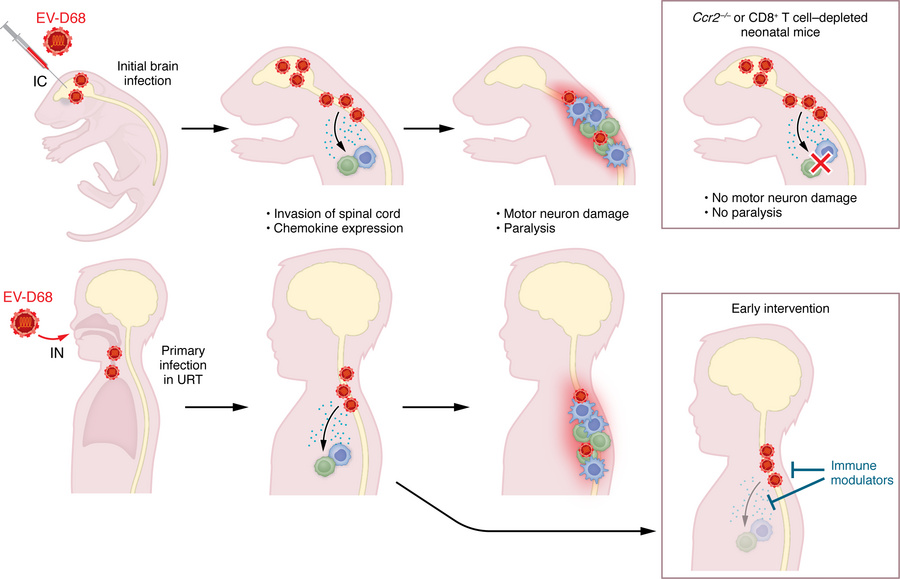 Neonatal WT mouse intracranial infection and CNS disease can parallel EV...