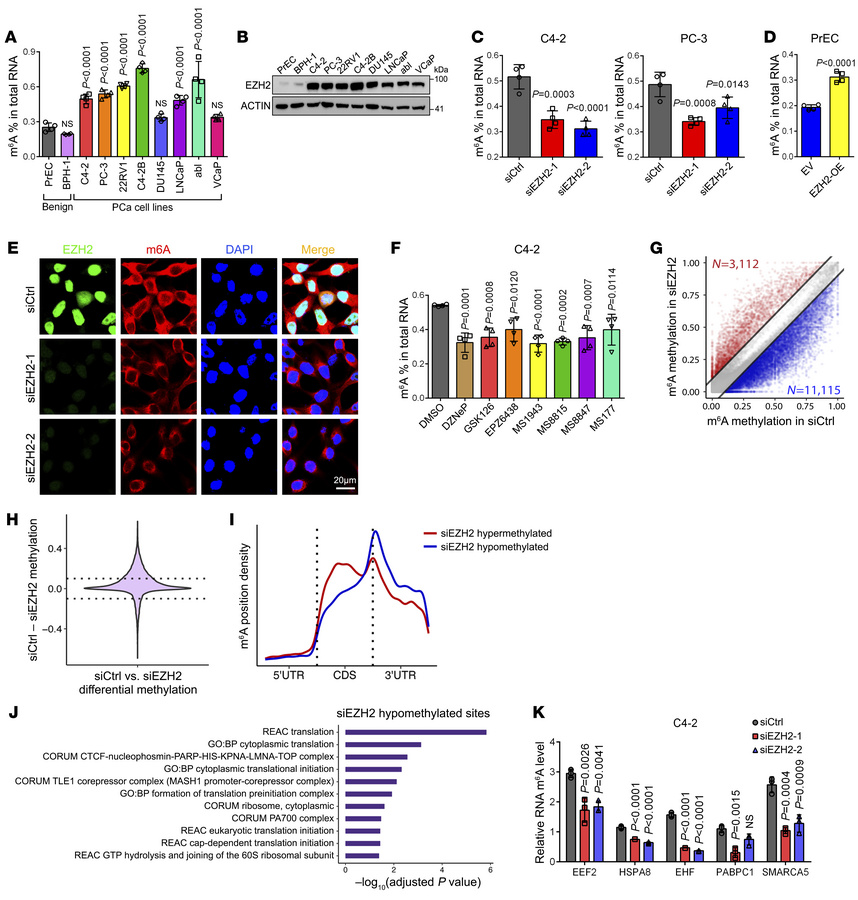 EZH2 maintains a hyper-m6A state in PCa cells.
(A) The m6A ELISA to meas...