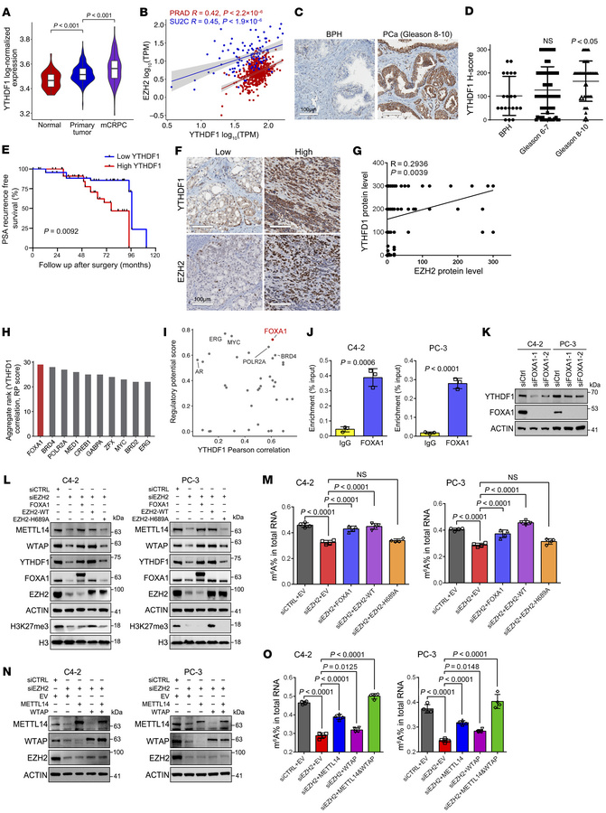 EZH2 activates YTHDF1 transcription through FOXA1 to regulate m6A global...