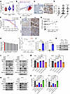 EZH2 activates YTHDF1 transcription through FOXA1 to regulate m6A globally.