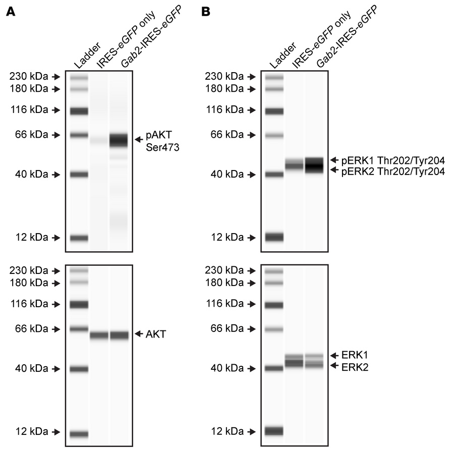 Retroviral overexpression of GAB2 increases phosphorylation of activatin...