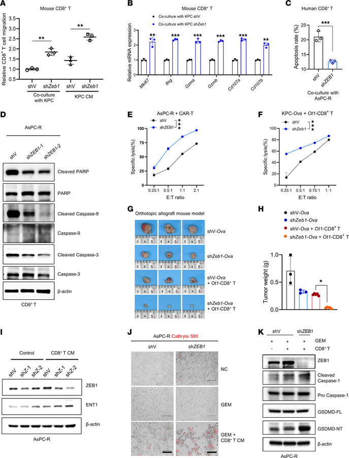 Blocking of ZEB1 enhances the antitumor activity of CD8+ T cells.
(A) CD...