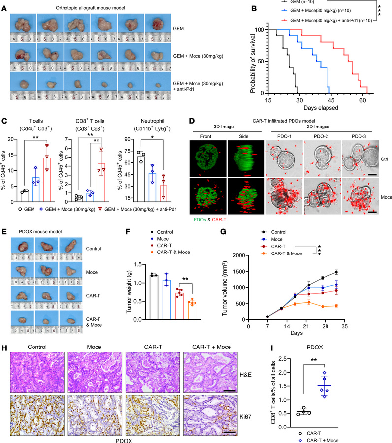 Mocetinostat enhances chemoimmunotherapy and CAR T efficacy in PC.
(A) T...
