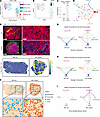 Increased infiltration of Gzma+ CD8+ T cells in tumor tissue with Zeb1 KD.