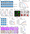 Mocetinostat enhances chemoimmunotherapy and CAR T efficacy in PC.